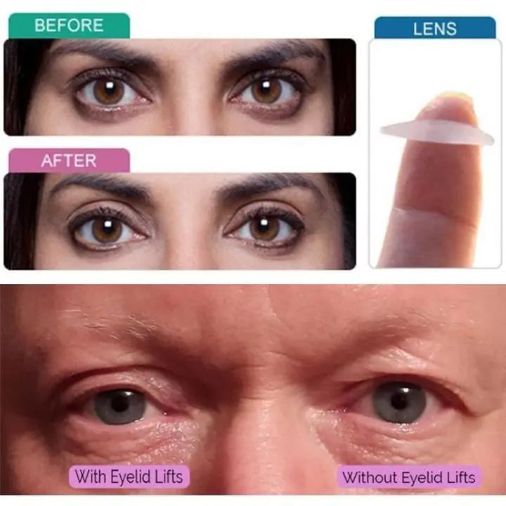 Instant Eye Lift